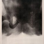 Abstract black and white image resembling medical imaging