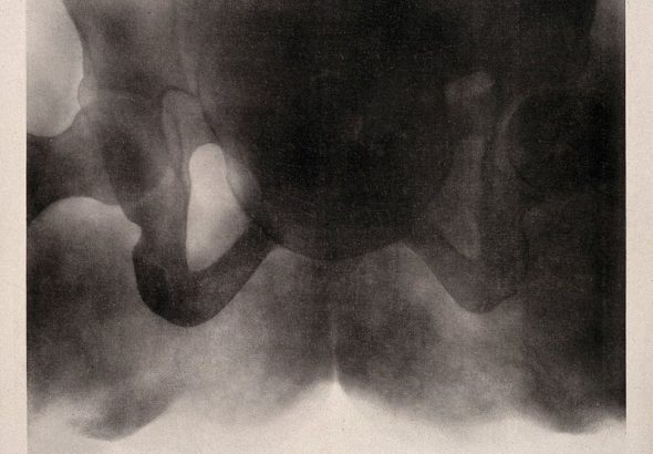 Abstract black and white image resembling medical imaging
