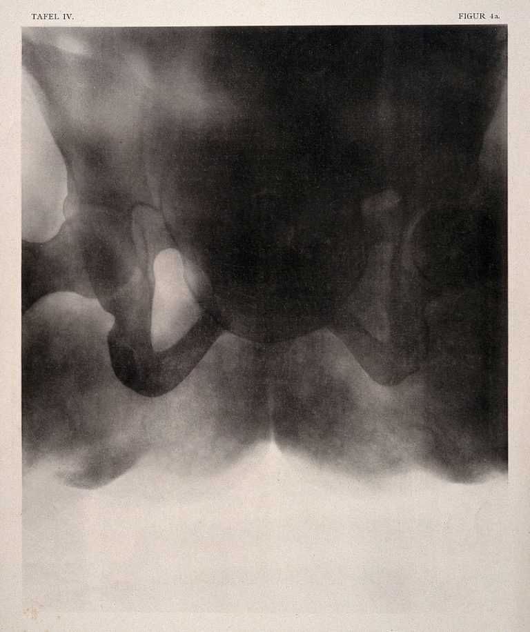 Abstract black and white image resembling medical imaging