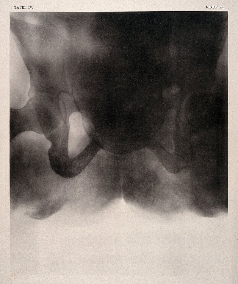 Abstract black and white image resembling medical imaging